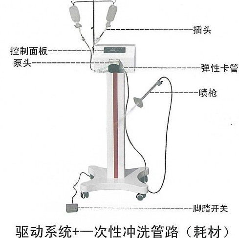 盈諾骨科沖洗器,同沖同吸不堵塞