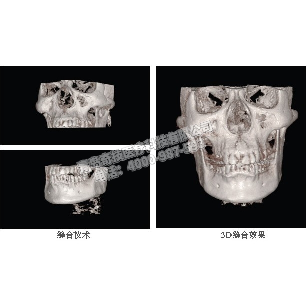 天津口腔CBCT 口腔全景機(jī)韓國HDX產(chǎn)品介紹