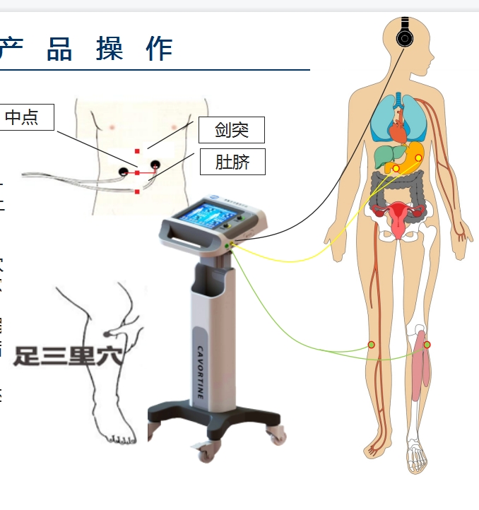 數(shù)字音樂電胃腸功能治療儀-消化內(nèi)科。重癥ICU