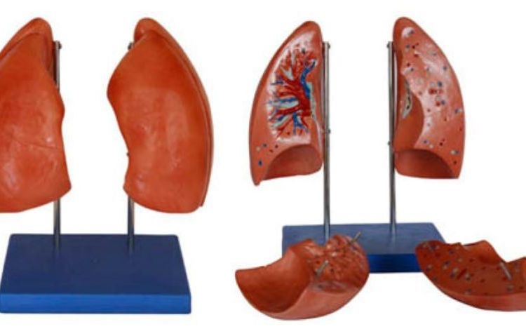肺解剖模型人體解剖模型醫(yī)學(xué)教學(xué)模型