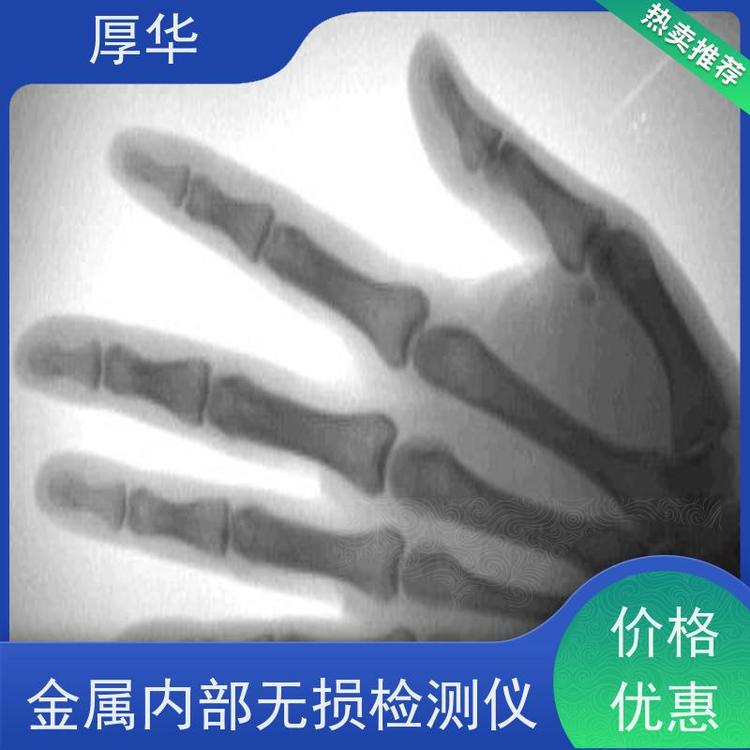 厚華手持式X射線機(jī)C型臂結(jié)構(gòu)結(jié)構(gòu)緊湊操作方便