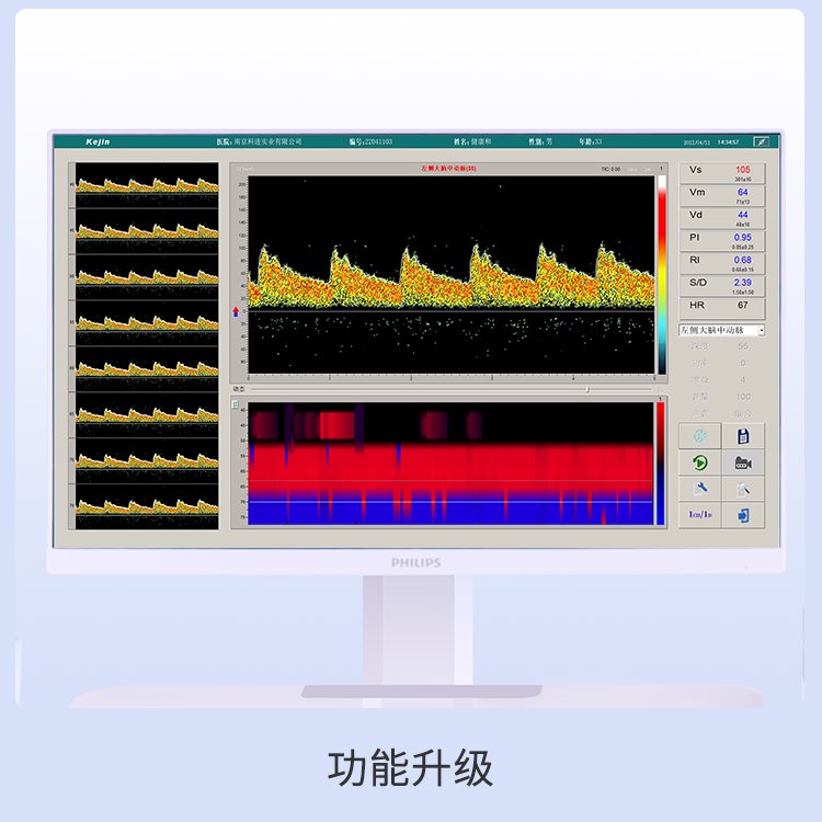 腦彩超檢測(cè)儀腦部血流分析TCD顱內(nèi)及淺表血管檢測(cè)發(fā)泡實(shí)驗(yàn)