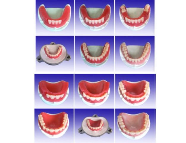 全口制作步驟醫(yī)學教學模型